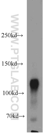 PARP1 Antibody in Western Blot (WB)