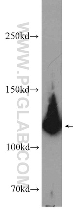 PARP1 Antibody in Western Blot (WB)