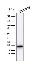 MART-1/Melan-A/MLANA Antibody in Western Blot (WB)