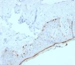 MART-1/Melan-A/MLANA (Melanoma Marker) Antibody in Immunohistochemistry (Paraffin) (IHC (P))