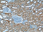 ATG2A Antibody in Immunohistochemistry (Paraffin) (IHC (P))