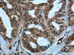 TAZ Antibody in Immunohistochemistry (Paraffin) (IHC (P))