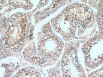 STAG3 Antibody in Immunohistochemistry (Paraffin) (IHC (P))