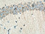 PHACTR1 Antibody in Immunohistochemistry (Paraffin) (IHC (P))