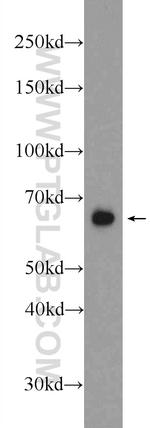 PHACTR1 Antibody in Western Blot (WB)