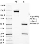 FOLH1/PSMA (Prostate Epithelial Marker) Antibody in SDS-PAGE (SDS-PAGE)