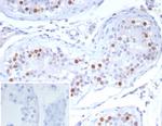 PRAME nuclear receptor transcriptional regulator Antibody in Immunohistochemistry (Paraffin) (IHC (P))