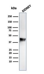 AMACR/p504S (Prostate Cancer Marker) Antibody in Western Blot (WB)