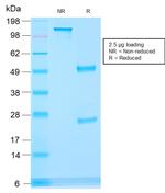 AMACR/p504S (Prostate Cancer Marker) Antibody in SDS-PAGE (SDS-PAGE)