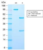 AMACR/p504S Antibody in SDS-PAGE (SDS-PAGE)