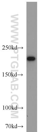 SNRNP200 Antibody in Western Blot (WB)