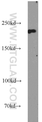 SNRNP200 Antibody in Western Blot (WB)