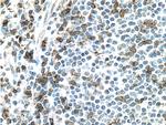 CD2 Antibody in Immunohistochemistry (Paraffin) (IHC (P))