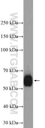 CD2 Antibody in Western Blot (WB)