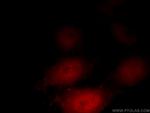 Glucocorticoid receptor Antibody in Immunocytochemistry (ICC/IF)