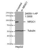 Glucocorticoid receptor Antibody in Western Blot (WB)