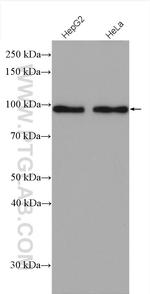 Glucocorticoid receptor Antibody in Western Blot (WB)