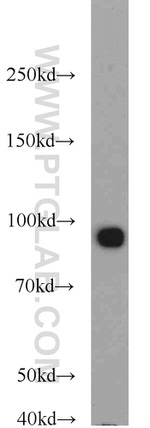 Glucocorticoid receptor Antibody in Western Blot (WB)