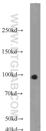 Glucocorticoid receptor Antibody in Western Blot (WB)