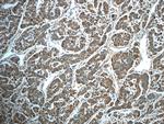 HPSE Antibody in Immunohistochemistry (Paraffin) (IHC (P))