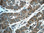 HPSE Antibody in Immunohistochemistry (Paraffin) (IHC (P))