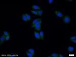 ZNF654 Antibody in Immunocytochemistry (ICC/IF)