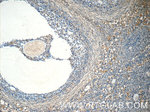 ZNF654 Antibody in Immunohistochemistry (Paraffin) (IHC (P))