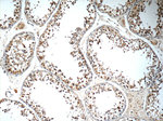 ZNF654 Antibody in Immunohistochemistry (Paraffin) (IHC (P))