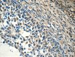 ZNF654 Antibody in Immunohistochemistry (Paraffin) (IHC (P))