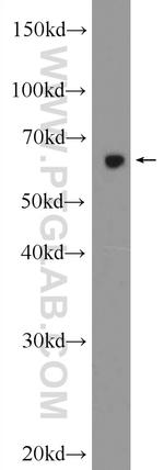 ZNF654 Antibody in Western Blot (WB)