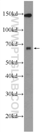 ZNF654 Antibody in Western Blot (WB)