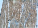 MBNL3 Antibody in Immunohistochemistry (Paraffin) (IHC (P))