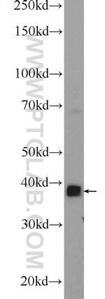 MBNL3 Antibody in Western Blot (WB)