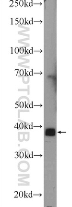 MBNL3 Antibody in Western Blot (WB)