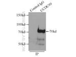 CCDC99 Antibody in Immunoprecipitation (IP)