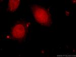 HELB Antibody in Immunocytochemistry (ICC/IF)