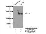 HELB Antibody in Immunoprecipitation (IP)