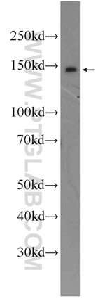 HELB Antibody in Western Blot (WB)