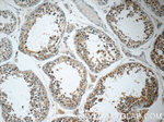 ZDHHC13 Antibody in Immunohistochemistry (Paraffin) (IHC (P))