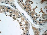 ZDHHC13 Antibody in Immunohistochemistry (Paraffin) (IHC (P))