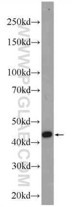 ZDHHC13 Antibody in Western Blot (WB)