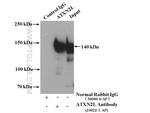 ATXN2L Antibody in Immunoprecipitation (IP)