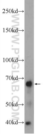 WDR81 Antibody in Western Blot (WB)