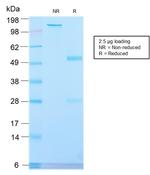 Alkaline Phosphatase (Placental)/PLAP Antibody in SDS-PAGE (SDS-PAGE)