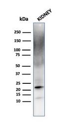 Ferritin, Light Chain (Node-Negative Breast Tumor Prognostic Marker) Antibody in Western Blot (WB)