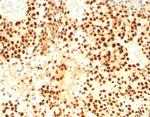 Steroidogenic Factor 1 (SF-1) Antibody in Immunohistochemistry (Paraffin) (IHC (P))