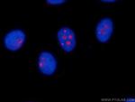 RSL24D1 Antibody in Immunocytochemistry (ICC/IF)