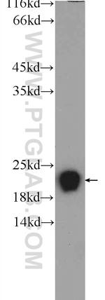 RSL24D1 Antibody in Western Blot (WB)