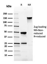 Gastrin Antibody in SDS-PAGE (SDS-PAGE)