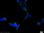 DTX4 Antibody in Immunocytochemistry (ICC/IF)